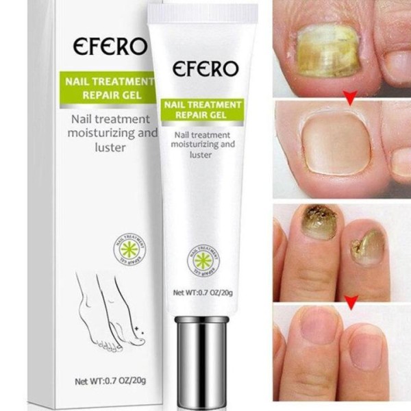 Efero Nail Treatment Repair Gel